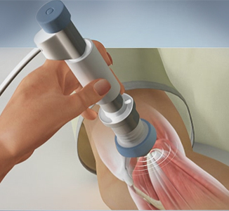 Tennis Elbow