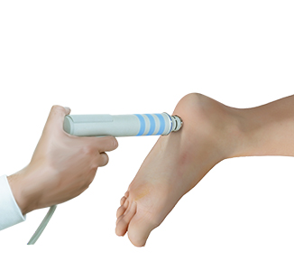 Plantar Fasciitis